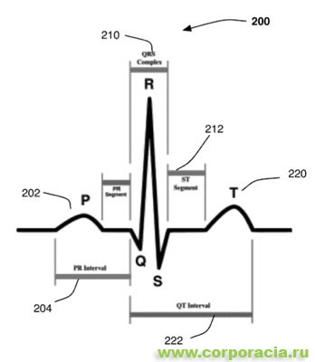 система безопасности iPhone
